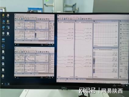 星空体育官网护航手术 西安市红会医院开展术中神经电生理远程网络监测(图3)