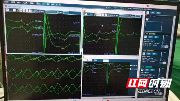 南华医院：新一代电生理监测为医生装上“精准之眼”星空中国体育网站(图1)