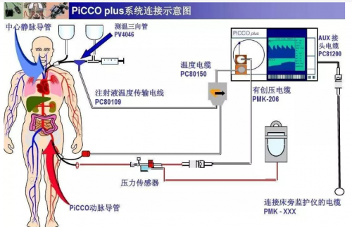 血流动力学之监测选择星空官方体育(图3)